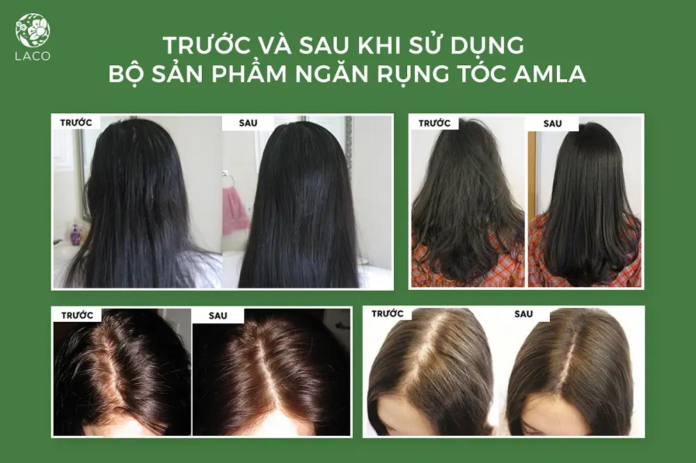 review dầu xả amla