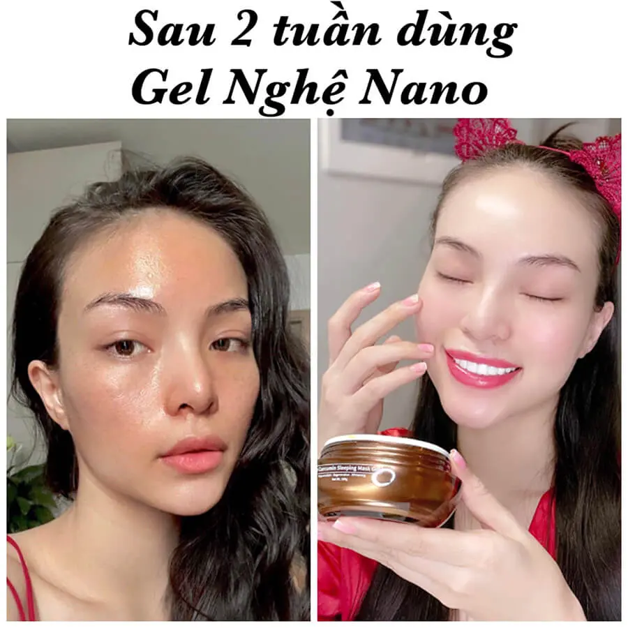 review gel mặt nạ ngủ moomery có tốt không myphamhera.com