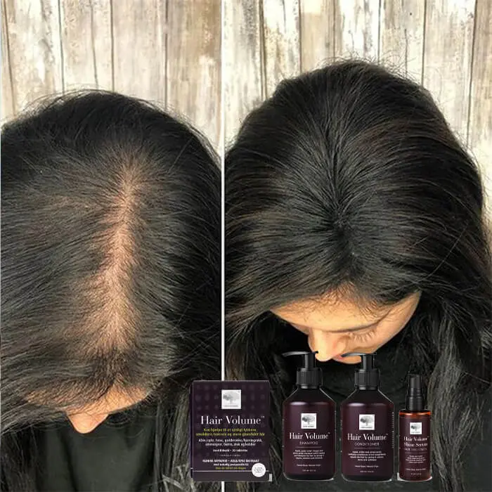 review bộ dầu gội viên uống new hair volume có tốt không