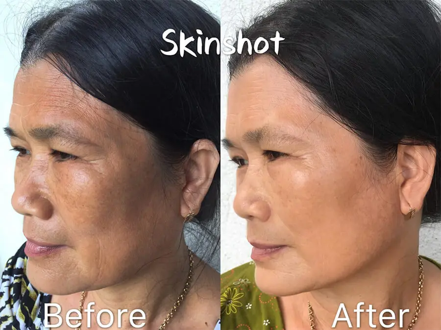 review nước uống collagen skin shot có tốt không myphamhera.com