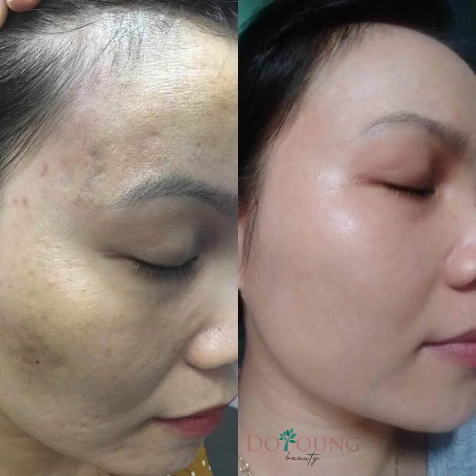 thạch collagen doyoung đỗ long có tốt không myphamhera.com