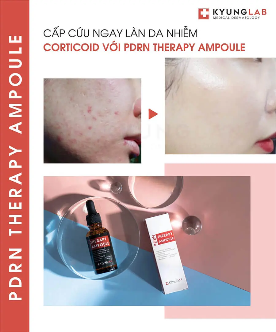 serum tế bào gốc kyunglab pdrn therapy ampoule có tốt không myphamhera.com