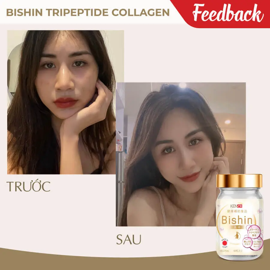 viên uống collagen bishin nhật bản có tốt không myphamhera.com