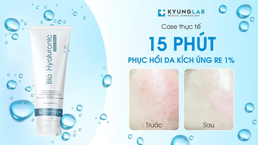 mặt nạ b9 kyung lab bio hyaluronic face mask có tốt không myphamhera.com