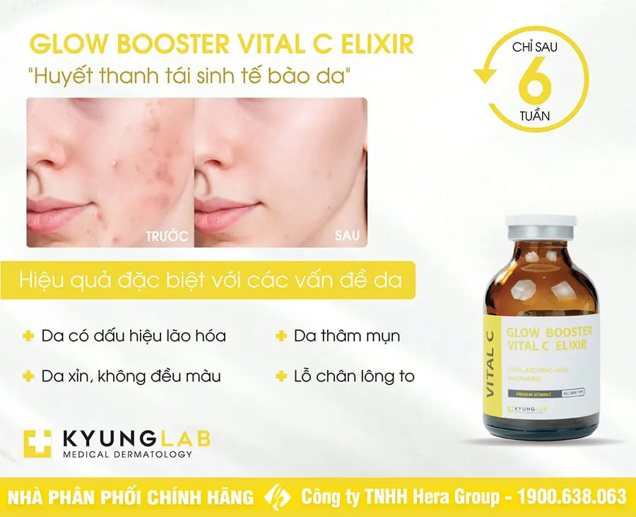 huyết thanh tái sinh tế bào da kyung lab vital c myphamhera.com