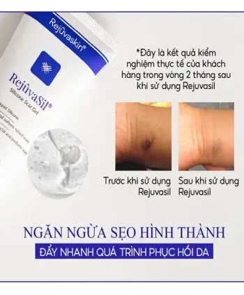 gel xóa mờ sẹo lồi sẹo phì đại scar rejuvasil myphamhera.com