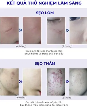 Kem trị sẹo thâm sẹo rỗ sẹo lõm scar esthetique rejuvaskin myphamhera.com