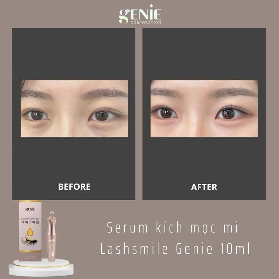 Serum dưỡng dài mi Genie Lashsmile có tốt không myphamhera.com