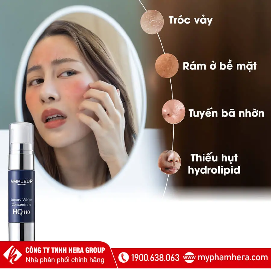 serum chuyên đặc trị nám tàn nhang luxury ampleur myphamhera.com