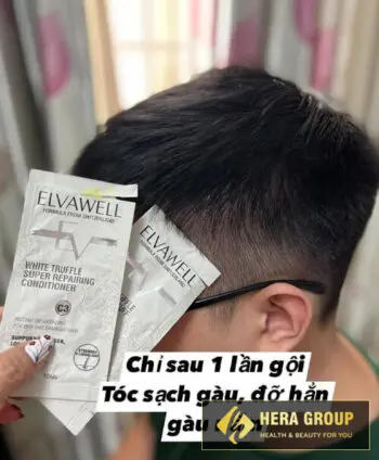 dầu gội giảm gàu elvawell myphamhera.com