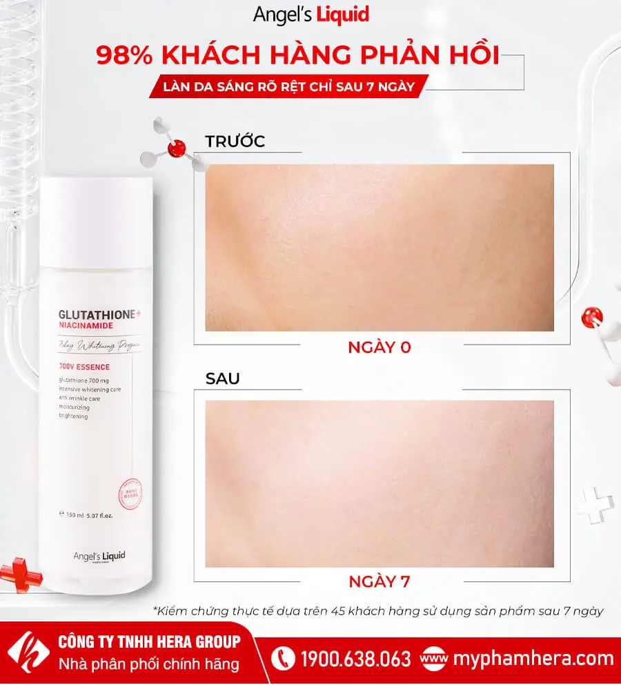 nước thần dưỡng trắng angels liquid myphamhera.com