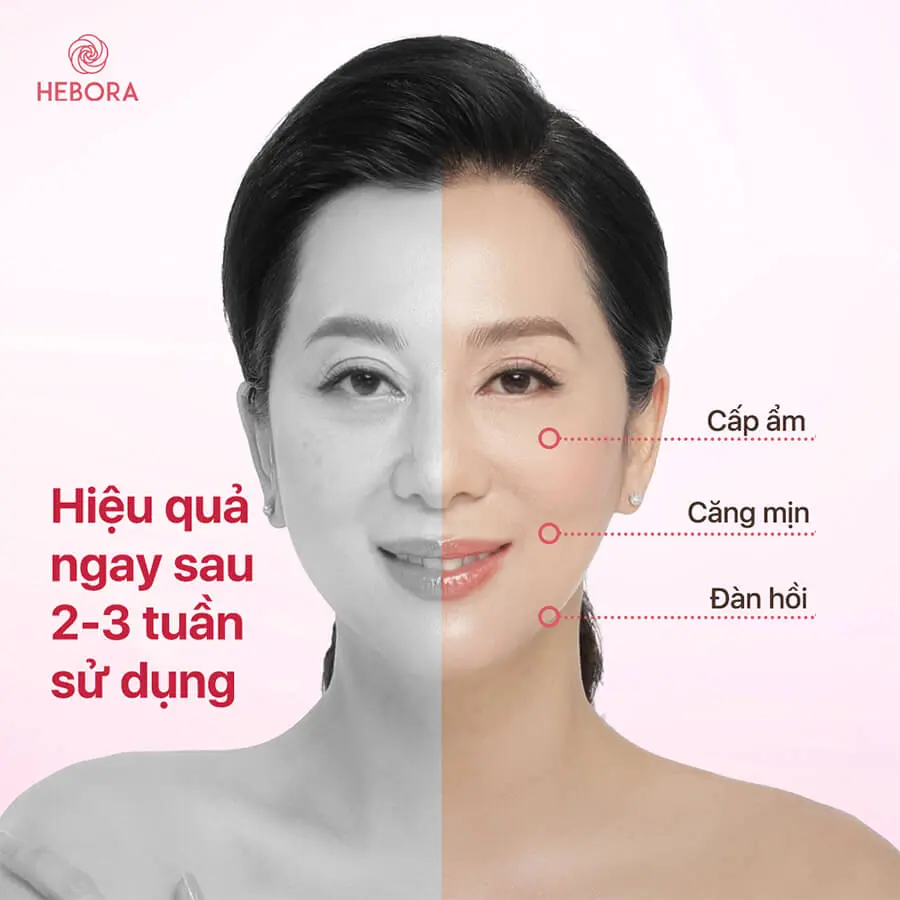 Lưu giữ vẻ đẹp thanh xuân nhờ vào nước uống Hebora Collagen Drink