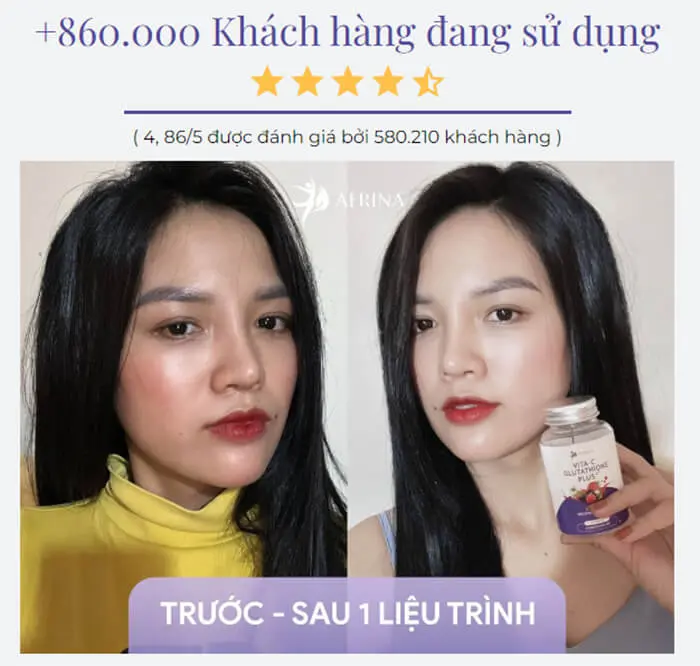 Viên uống trắng da Aerina có tốt không