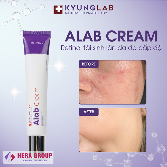 Kem retinol Kyung Lab Alab Cream có tốt không?