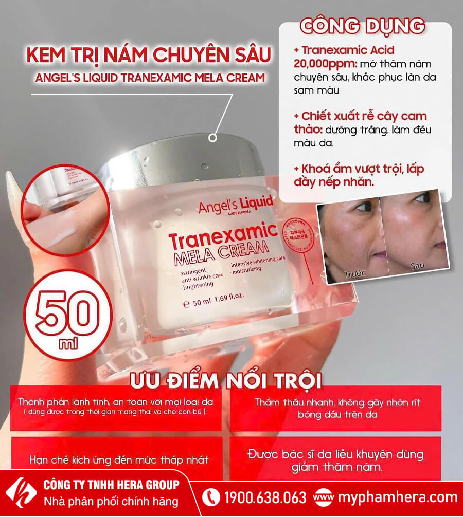 công dụng kem mờ nám chuyên sâu angel's liquid myphamhera.com