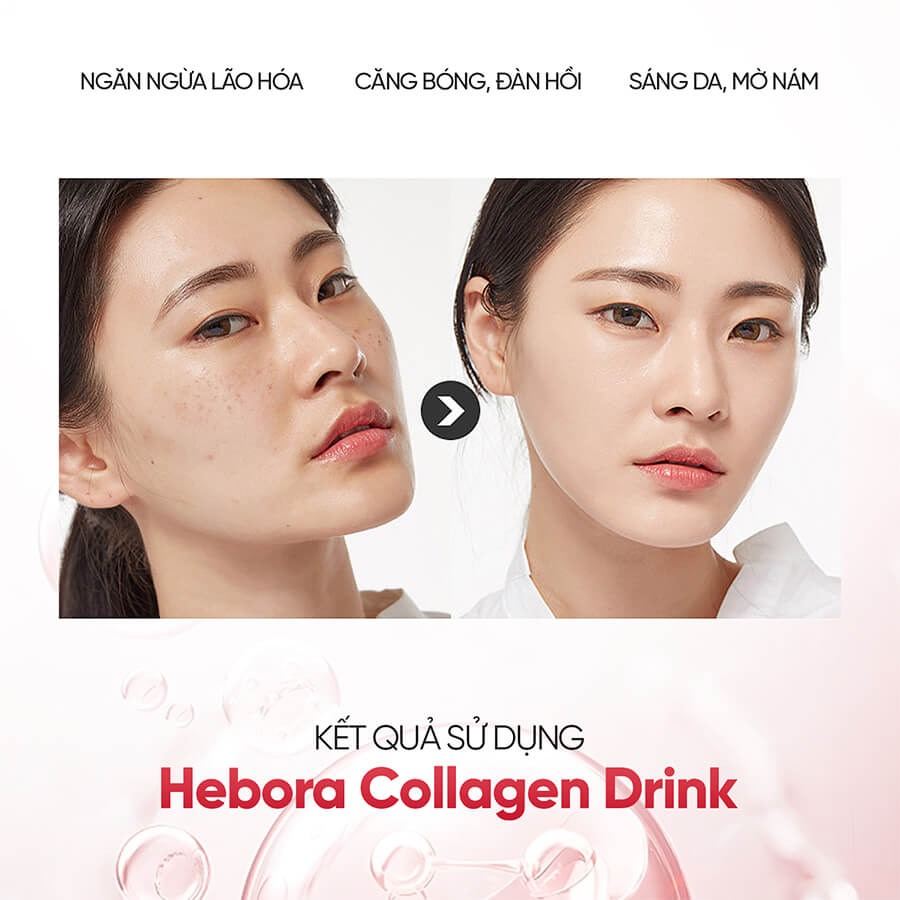 Giải pháp để có làn da trẻ đẹp nhờ vào Nước uống Hebora Collagen Drink